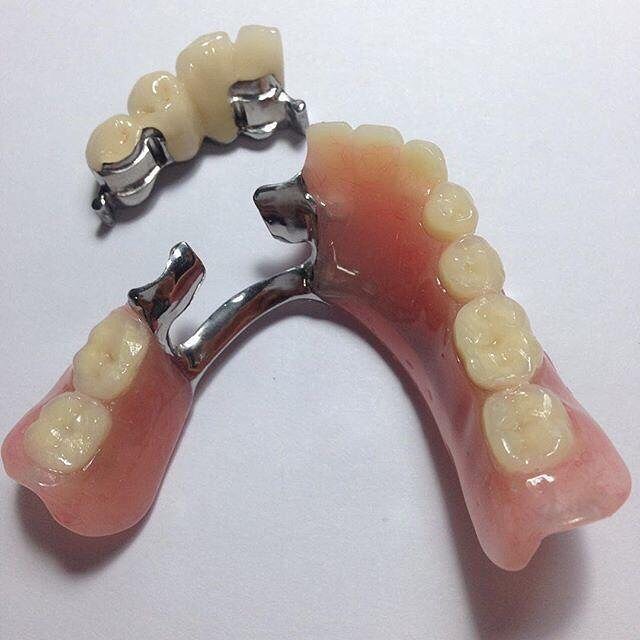 patients who have 2 or 3 teeth left